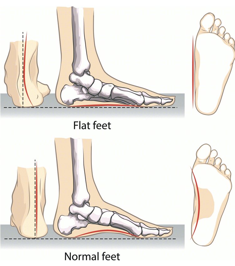 Orthopädische Schlupfschuhe für Frauen